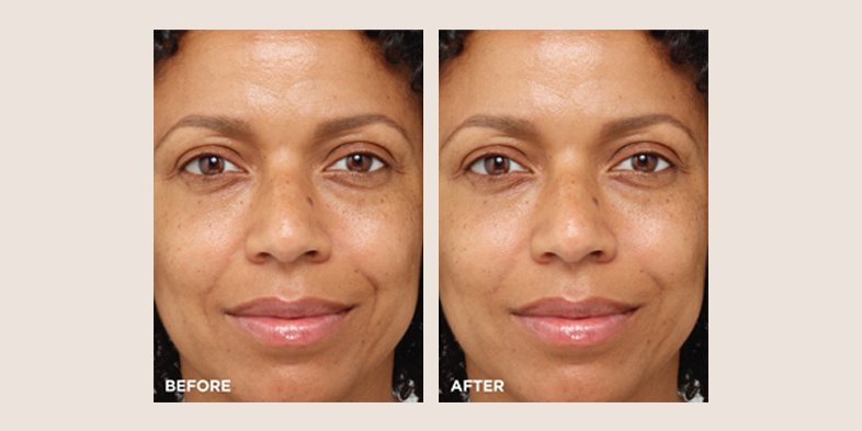 In Article Vitamin C And Hyaluronic Acid WaterCream 1